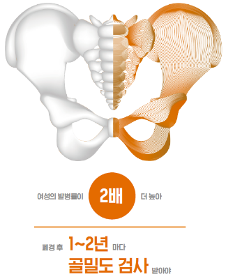 [100세 시대, 건강이 행복을 좌우한다] 정기적인 골밀도 검사와 적절한 치료가 고관절을 지킨다