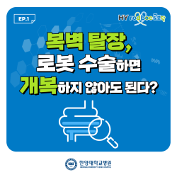 복벽 탈장, 로봇 수술하면 개복하지 않아도 된다?