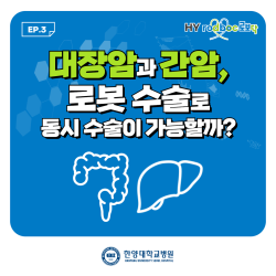 대장암과 간암, 로봇 수술로 동시 수술이 가능할까?