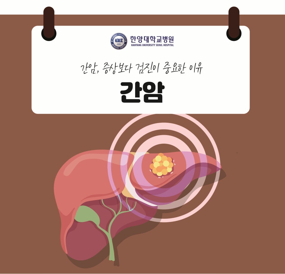 간암, 증상보다 검진이 중요한 이유