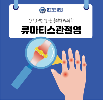 손이 보내는 경고를 놓치지 마세요! '류마티스관절염'