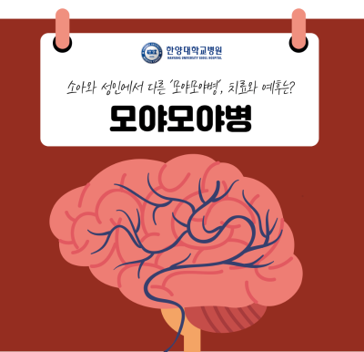 소아와 성인에서 다른 '모야모야병', 치료와 예후는?