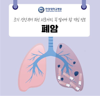 폐암, 조기 진단부터 최신 치료까지: 꼭 알아야 할 핵심 정보