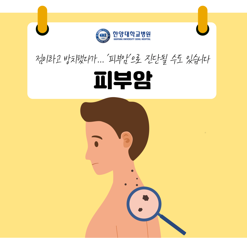 점이라고 방치했다가… '피부암'으로 진단될 수도 있습니다