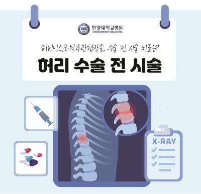 허리디스크·척추관협착증, 수술 전 먼저 고려해 봐야 할 시술 치료는?