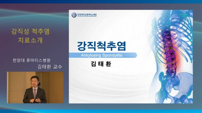 [동영상] 강직성 척추염 바로알기! 건강강좌 - 류마티스내과 김태환 교수