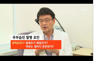 무좀? 습진? 약 잘 못쓰면 독