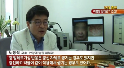 여름철 심해지는 알레르기는?