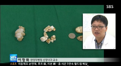 요로결석 가을에 많이 발생..."수분섭취 충분히 해야"