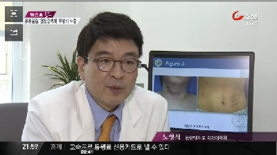 두루마리 화장지 형광증백제에 무방비 노출