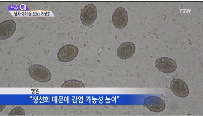 13살 소년 몸에서 3.5m 기생충이...