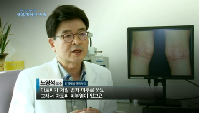 당신의 아이가 위험하다_소아 아토피