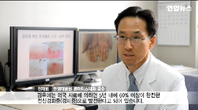 피부가 두껍고 딱딱해질 때...치명적 인 병(?)
