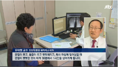 [JTBC뉴스]류마티스 관절염, 먹는 약 등장…내년부터 처방 가능