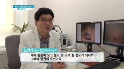 [무엇이든물어보세요]여름철 약화된 면역력을 노린다! 대상포진 주의보