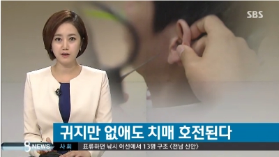 귀지 제거했더니 치매 호전…놀라운 결과
