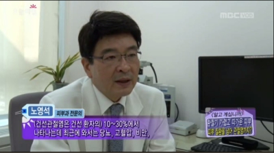 [생방송오늘아침]건성관절염
