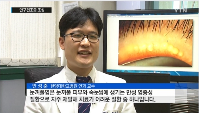 눈꺼풀에도 여드름 생긴다...안구건조증 조심