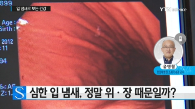 [사이언스] 입 냄새, 원인질환 따로 있다? 입냄새로 보는 건강