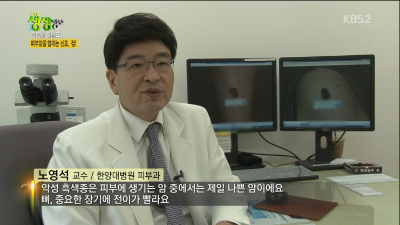 [생생정보]피부암을 알리는 신호, 점!