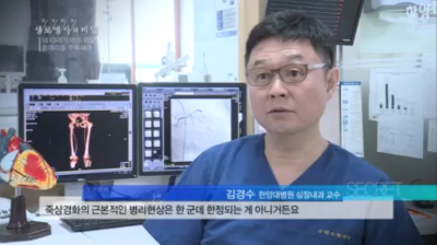 [1TV생로병사의비밀]내 다리가 아픈 이유, 종아리를 주목하라!