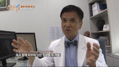 [세상에이런일이]등 혹 할아버지