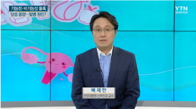 [사이언스투데이]흔한 여성 질환...난소물혹에 대한 모든 것