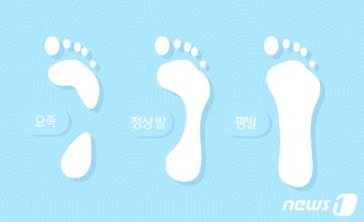 평발 아닌데 조금만 걸어도 아프다…혹시 요족?
