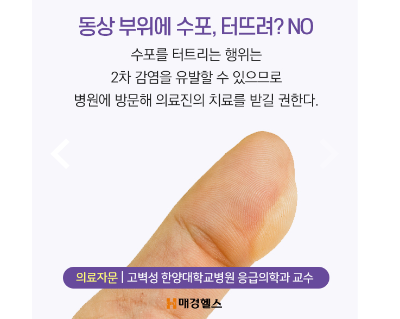 [알쓸건잡] 동상 걸렸을 때? 비비지 말고 OO하세요