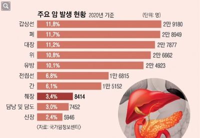 황달·명치 통증 지속… 갑자기 당뇨 악화된다면 췌장암일 수도