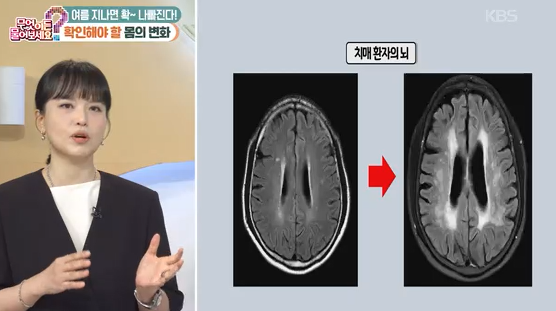 [무엇이든 물어보세요] 여름 끝, 피부𐤟뼈𐤟뇌 건강 체크