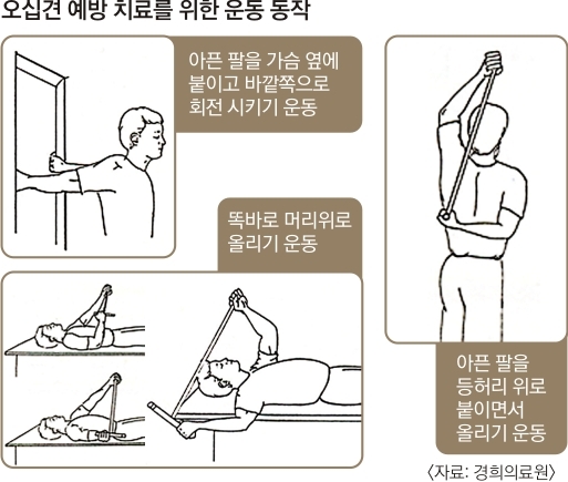 스스로 팔 들어올릴때만 통증 있다면… 회전근개 파열 의심하세요 