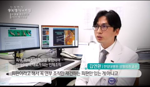 KBS 생로병사의 비밀_재건성형