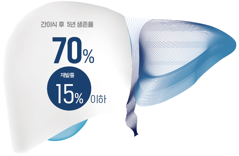 간이식 후 5년 생존율 70%, 재발률 15% 이하