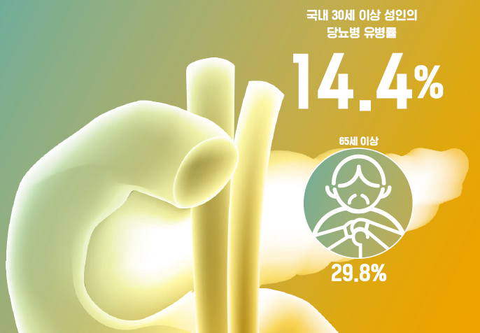 국내 30세 이상 성인의 당뇨병 유병률, 14.4% (65세 이상 29.8%)
