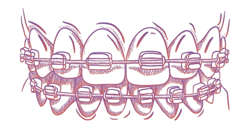 부정교합과 안면비대칭 어떻게 개선할까? 보톡스·안면윤곽술·치아교정